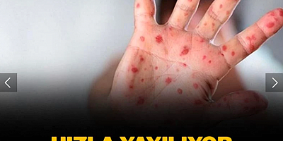 Virüs hızla yayılıyor! Tüm dünya teyakkuzda