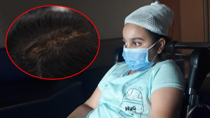 Trafiğe çıkması yasak forklift 9 yaşındaki kıza çarptı!