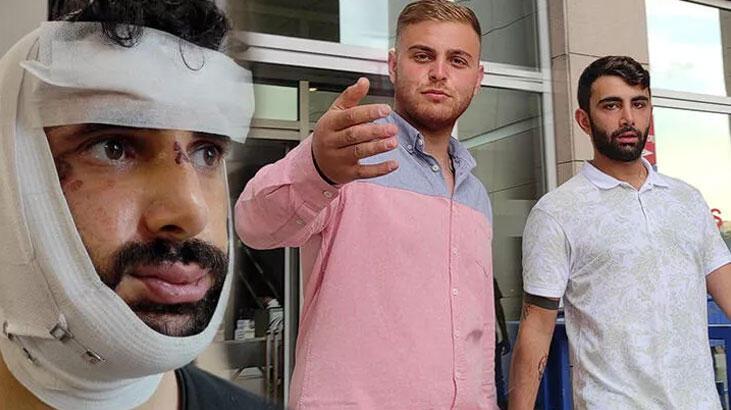 Trafikte gazetecinin çenesini kırmışlardı! Savcı 6 yıl hapis cezası talep etti
