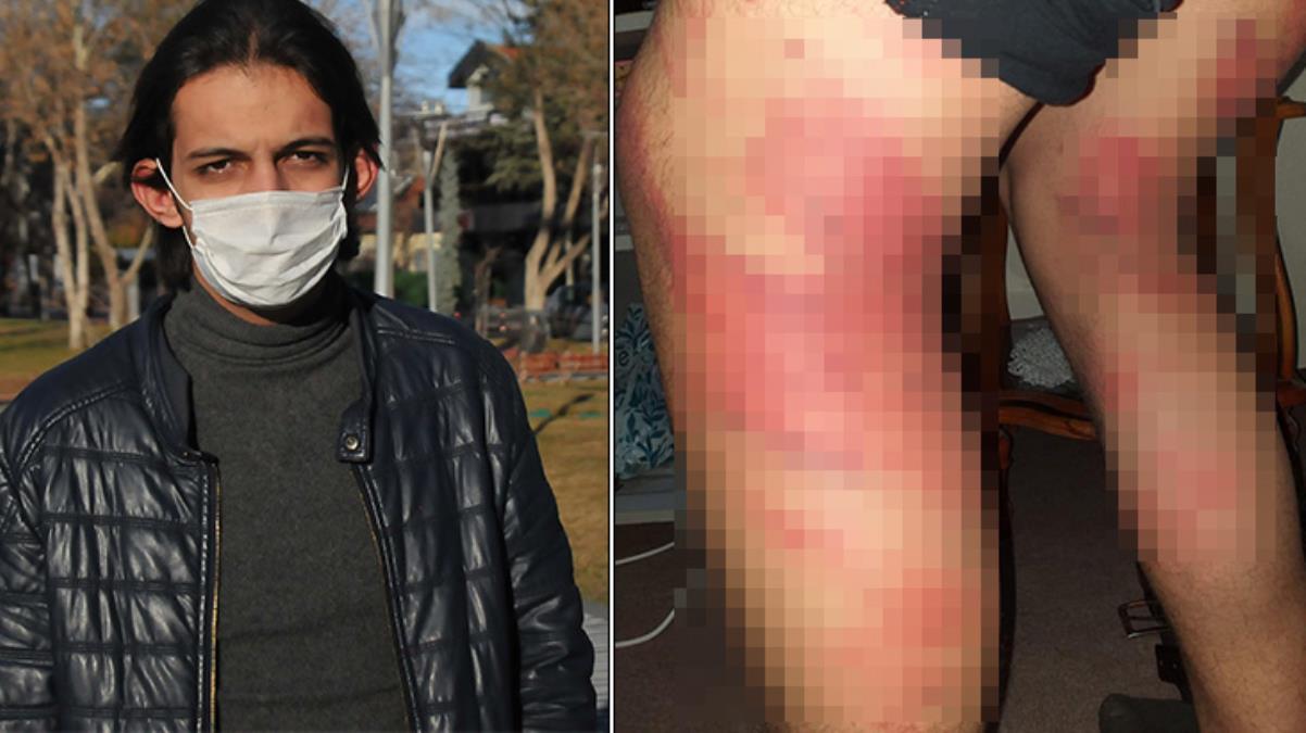 Triger kayışıyla dayak yiyen çırak, ustasına verilen cezaya isyan etti: Dayak yediğimle kaldım