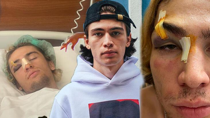 Türkiye şampiyonu milli sporcuya dayak 'Kaykayla vurdular'