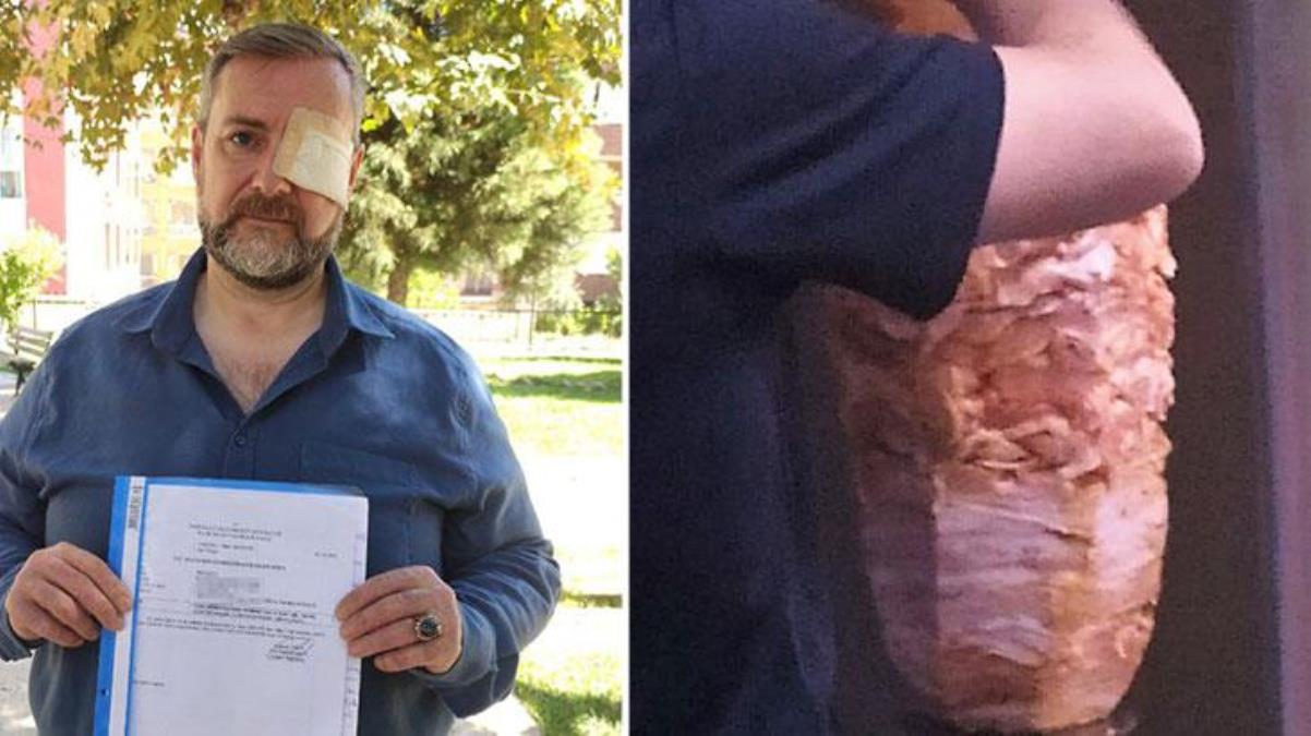 Ünlü döner zincirinin şefi, halka tarihi geçmiş eti satmadı diye dövülüp kör edildi