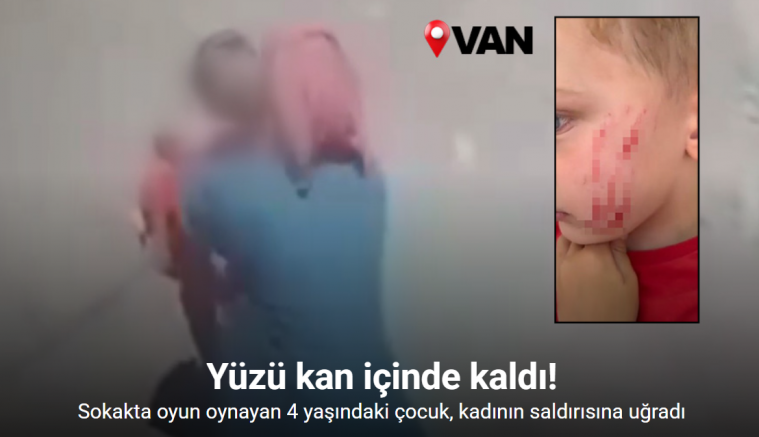 Van’da sokakta oynayan çocuğa saldırı: O anlar kamerada