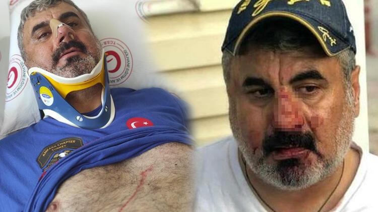 Vazife malulü engelliyi dövdüler