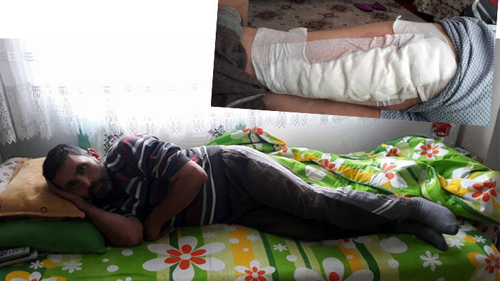 Yaban domuzu saldıran çiftçinin bacağına 60 dikiş atıldı