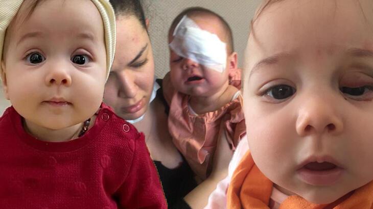 Yanlış teşhis koyup ameliyat edildi! 7 aylık bebek bu hale geldi