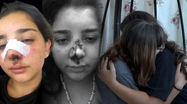 Yaşadığı dehşeti ağlayarak anlattı: Rüyalarımdan çıkmıyor