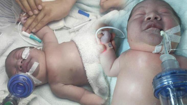 Yeni doğan bebeğin köprücük kemiği kırıldı, vücudu mosmor oldu