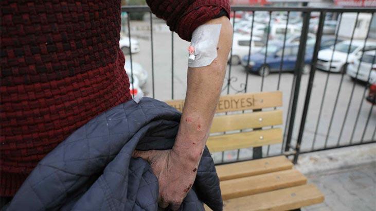 Yolda yürüdüğü sırada pitbull saldırısına uğradı