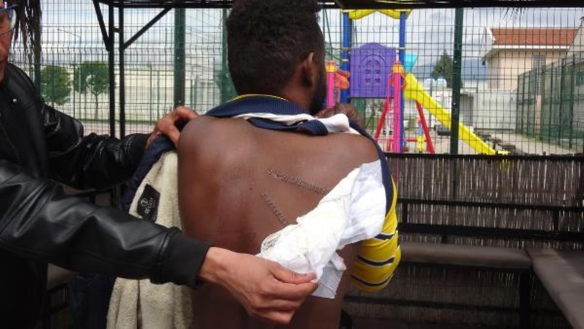 Yunan askerlerinin sırtından bıçakladığı Yemenli Abdullah'ın yaralarına 30 dikiş atıldı