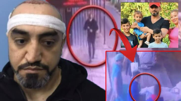 Yürüyerek girdi cenazesi çıktı! Saç ekiminde skandal ölüm