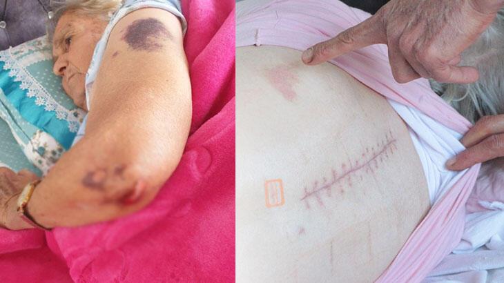 Yürüyerek girdiği hastaneden yatalak çıktı, darp edildiğini öne sürdü