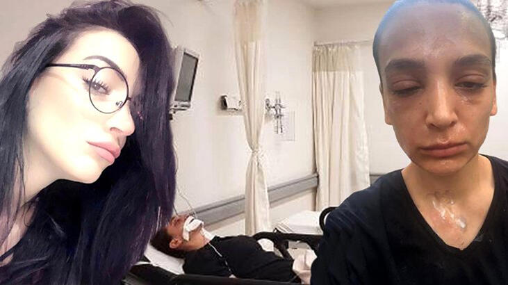 'Yüzüme lavabo açıcı patladı' iddiası... 1,5 milyon liralık tazminat davası açtı